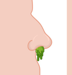 Booger Nose Green Slime Dripping From His Nostril