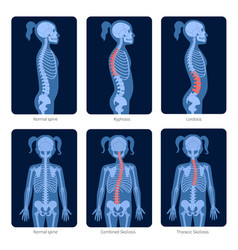 Spine X Ray