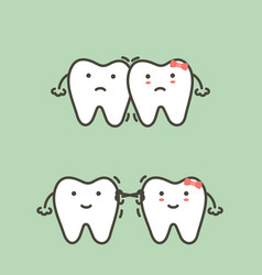 Crowding Teeth - Malocclusion