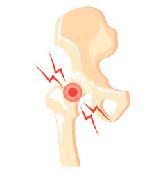 Hip Joint Pain Icon Cartoon Bone Ache