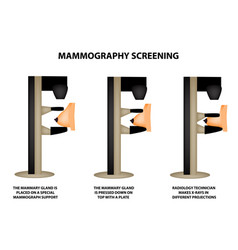 Mammography Mammographic World Breast Cancer Day