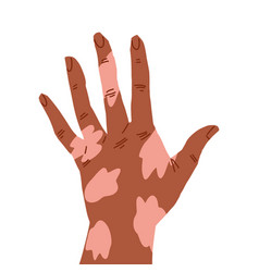 Hand Back Of The Palm In Relaxed Gesture Brown