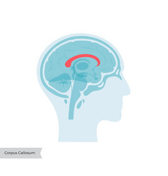 Corpus Callosum