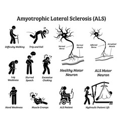 Amyotrophic Lateral Sclerosis Als Disease Signs