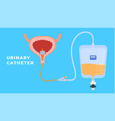 Urinary Medical Sterile Catheters For Patient