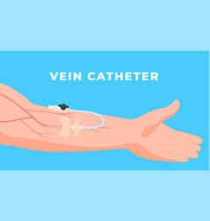 Venous Medical Sterile Catheters For Patient