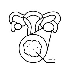 Polycystic Ovary Syndrome Endocrinology Line Icon