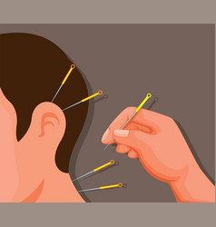 Chinese Traditional Acupuncture