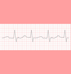 Black Heart Beat Diagram Printed On Red Graph