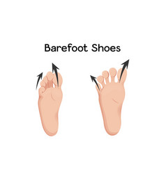 Compare Feet Before And After Barefoot Shoes