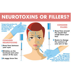 Neurotoxins Or Fillers Infographics Neurotoxin