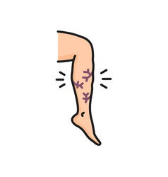 Varicose Vein Venous Edema On Leg Line Icon