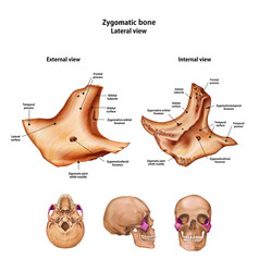 Snn Zygomatic Bone