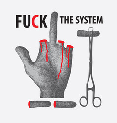 Human Hand With The System With Blood