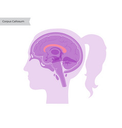 Corpus Callosum