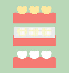 Step Of Usage Teeth Whitening Strip