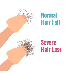 Hair Shedding Versus Loss Medical Diagram