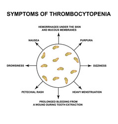 Symptoms Thrombocytopenia Reducing Platelets