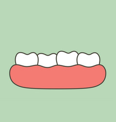 Crowding Teeth Or Malocclusion