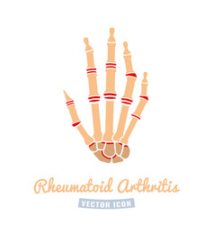 Rheumatoid Arthritis Icon