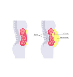 Visceral Fat Diagram