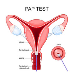 Pap Test Procedure Cross Section Of A Human