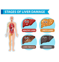 Diagram Showing Stages Of Liver Damage