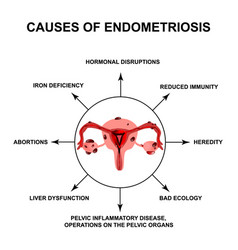 Causes Endometriosis Adenomyosis