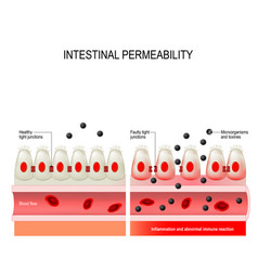 Leaky Gut Intestinal Permeability