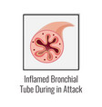 asthma attack tube composition vector image vector image