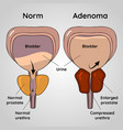 Kidneys and bladder Royalty Free Vector Image - VectorStock