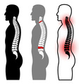 human spine silhouettes vector image
